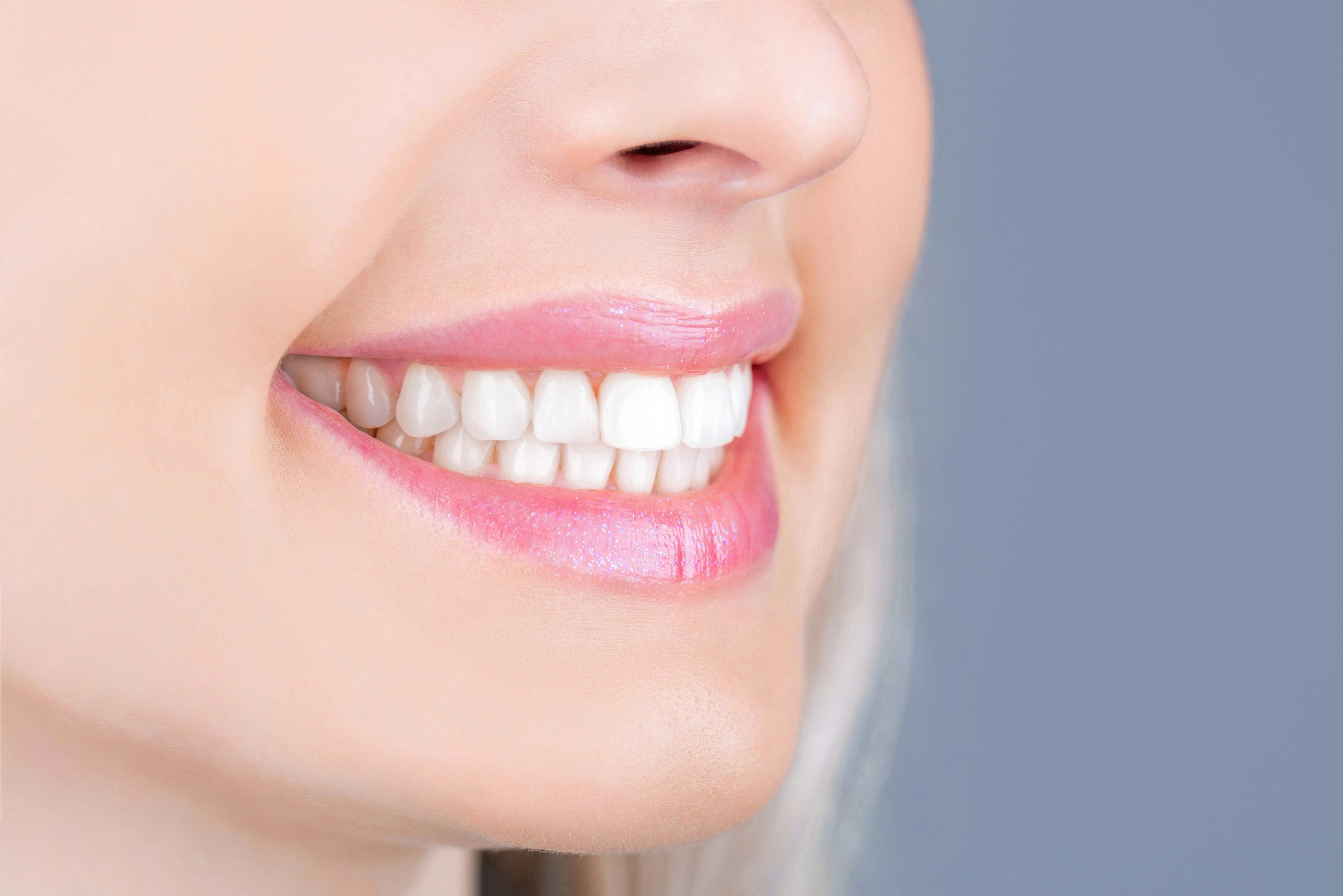 Teeth Whitening: A Quick Smile Fix