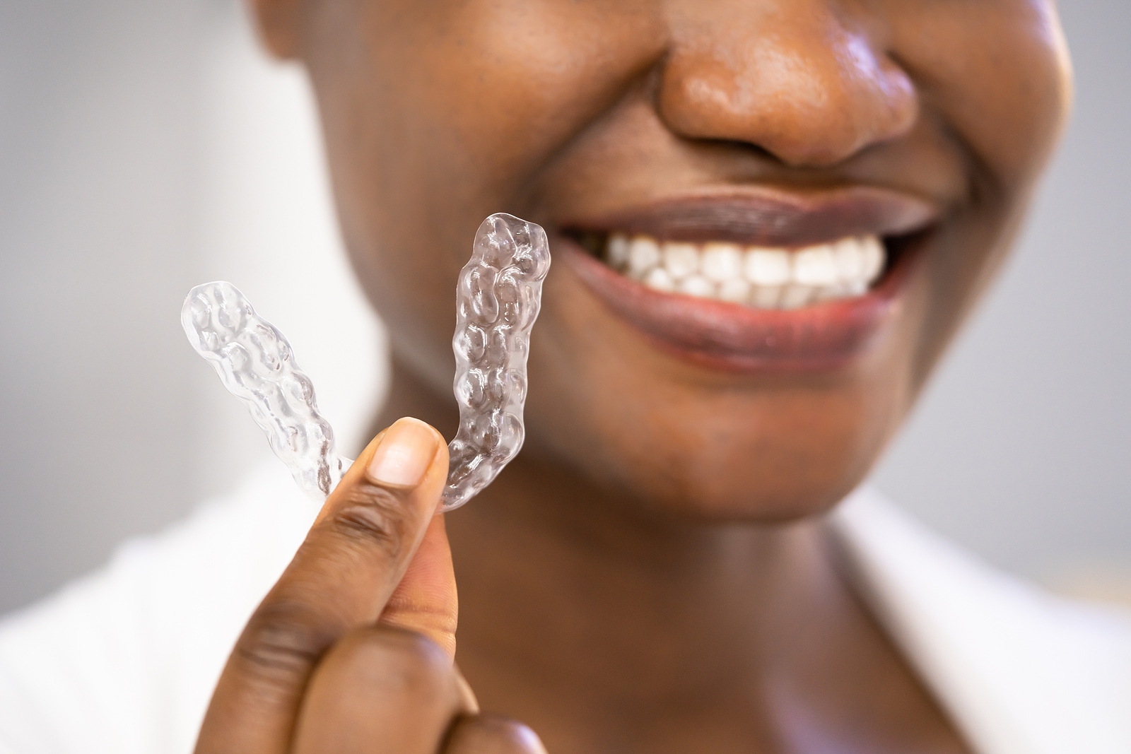 The Ultimate Guide to Clear Aligners in Springfield, MO: Achieving a Straighter Smile