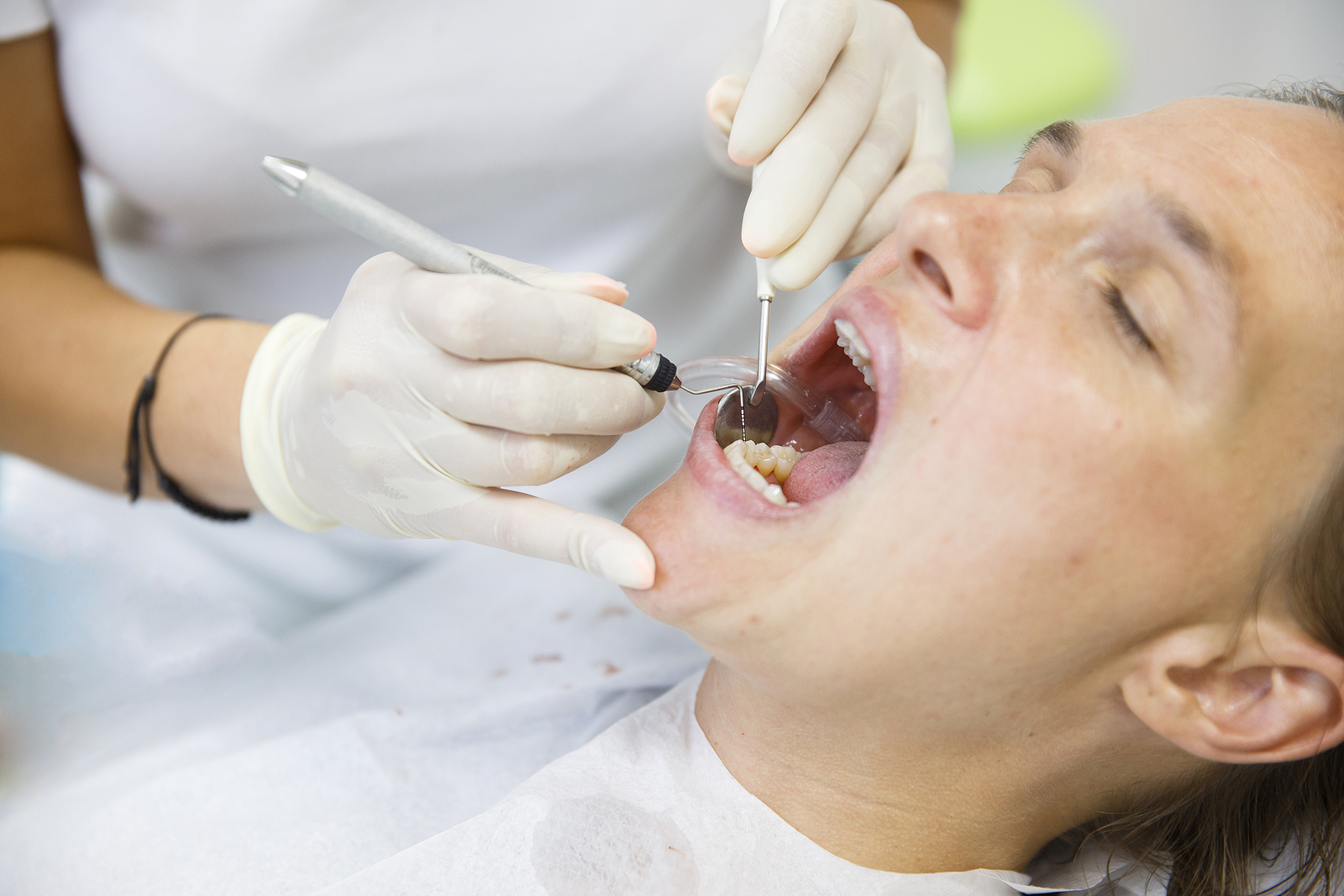 What to Expect After a Dental Implant Treatment: A Comprehensive Aftercare Guide